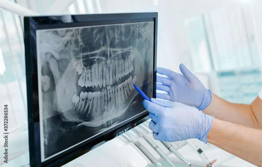 Digital-xrays-advanced-technology Digital x-rays advanced technology