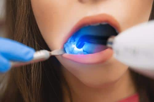 Go-dental-advanced-technology-laser-dentistry Go dental advanced technology laser